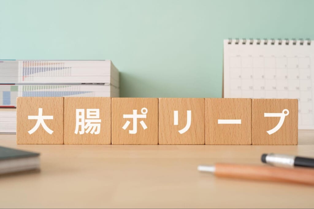 大腸ポリープができやすい人とは？原因や症状・放置するリスクを解説